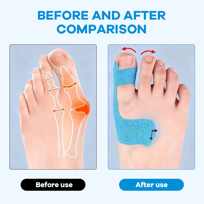 ✨Wear Any Shoes You Love—Without the Bunion Pain! 👠💃